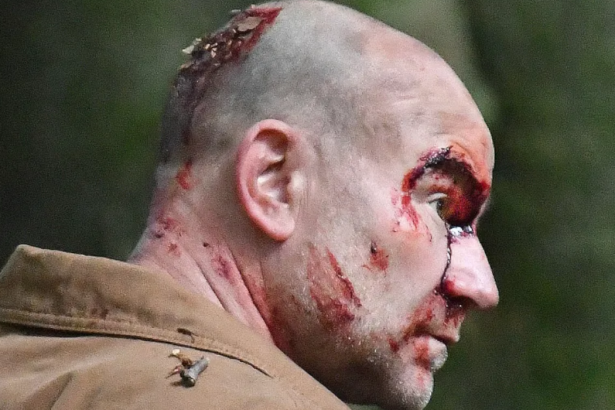 tim-injured-coronation-street