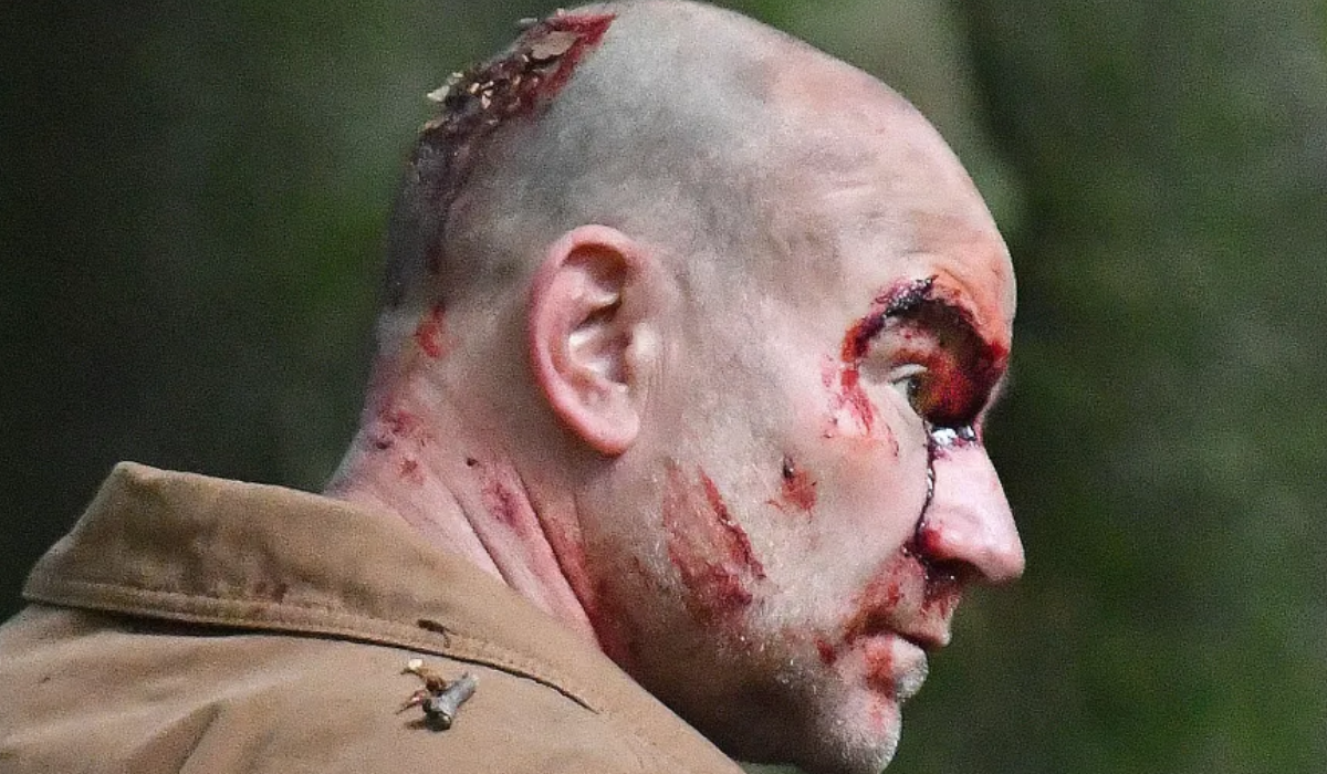 tim-injured-coronation-street