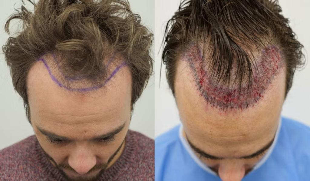 jack-hair-transformation-coronation-street